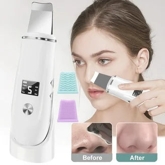 Electric blackhead pore remover